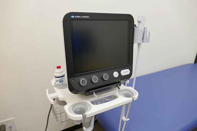 超音波画像診断装置SONIMAGE MX1