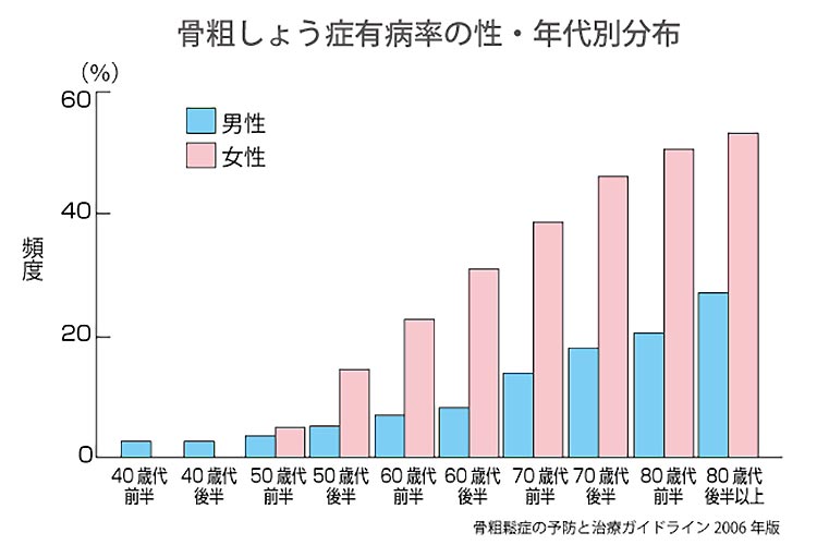骨粗鬆症の病有率の性・年代別分布